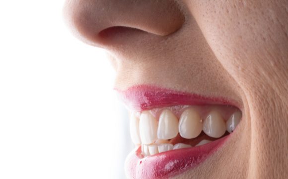 5 formas de manter os seus dentes brancos