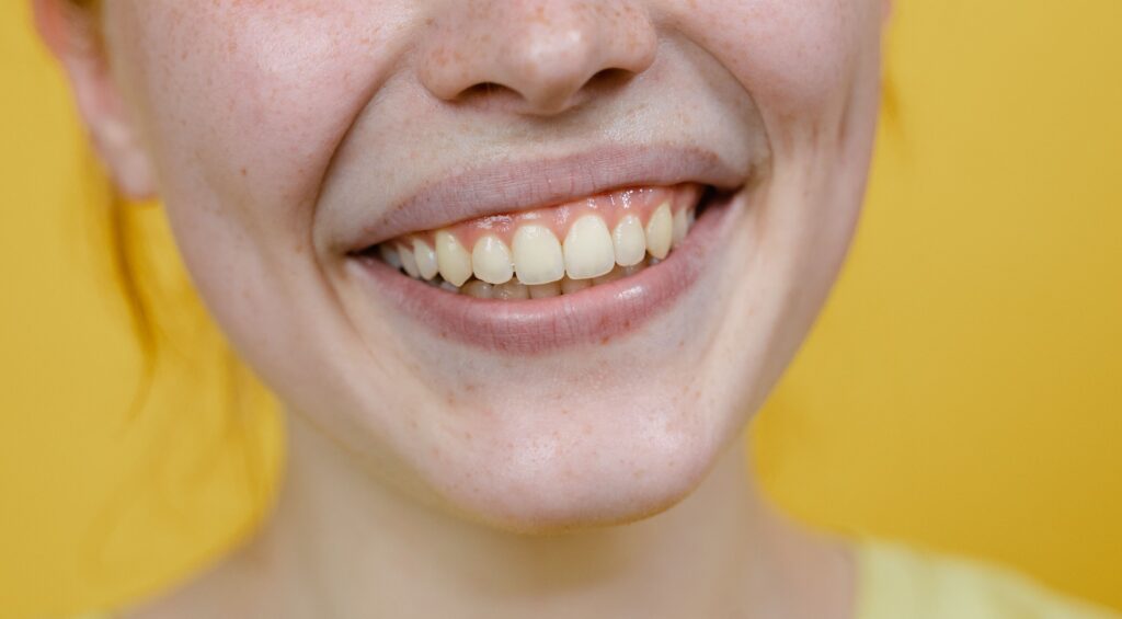 Causas e soluções para o "Sorriso Gengival"